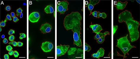 Immunofluorescent Staining Of Monocytes And Macrophages A Monocytes