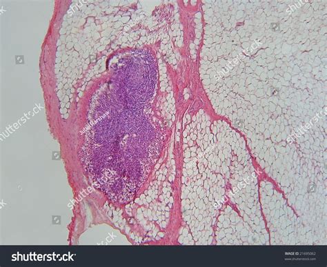 Parathyroid Gland X Stock Photo Shutterstock