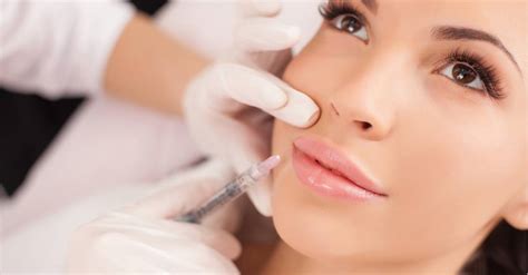 Guide To Dermal Filler For Smile Lines SDBotox