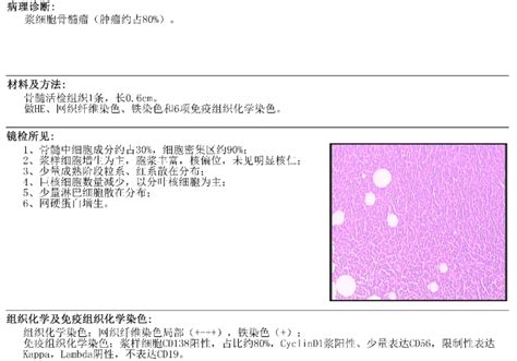 一例双克隆多发性骨髓瘤的诊断 腾讯新闻