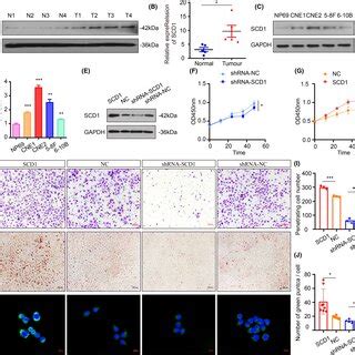 Hypoxic Adipocytederived Exosomes Promote CNE2 Cell Proliferation