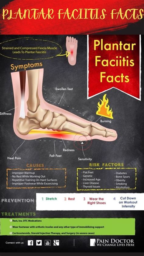 What is plantar fasciitis symptoms prevention and treatment – Artofit