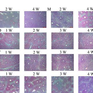 Comparison Of Liver Histology In Mice With Dmn Induced Liver Cirrhosis