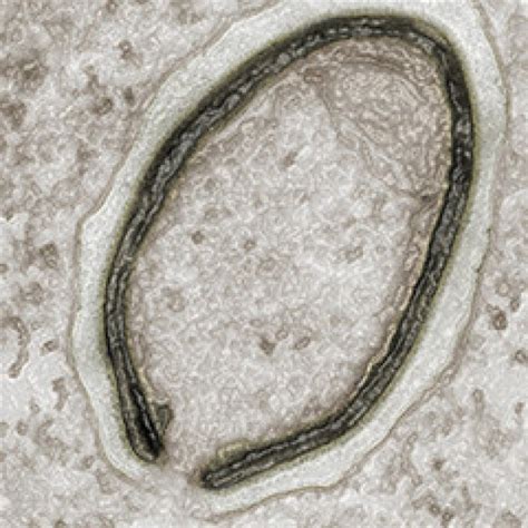 Scientists Revive Largest Virus Yet From 30000 Year Old Permafrost