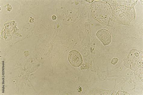 Epithelial Cells Under Microscope