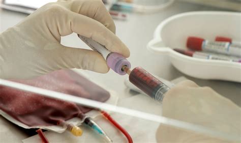 Hiv Breakthrough As Man Cured Of Virus After Successful Stem Cell