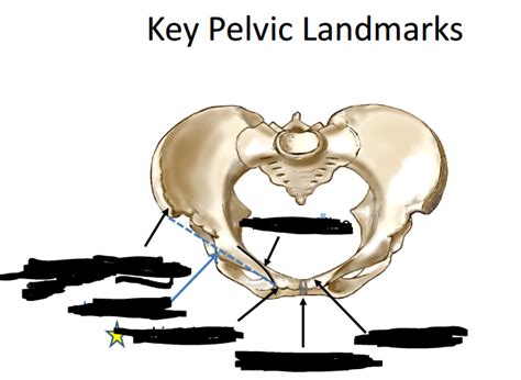 Gu Anatomy Lecture Pelvis Diagram Quizlet