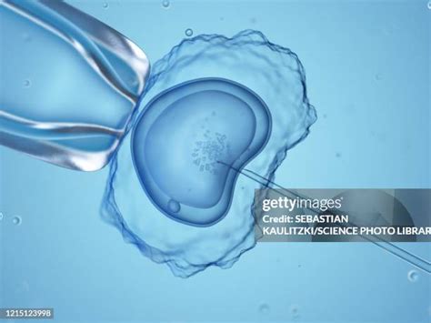 Human Artificial Insemination Stock Fotos Und Bilder Getty Images