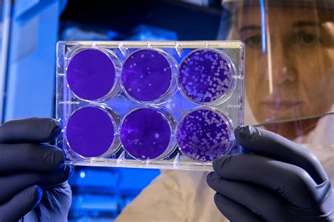 Intensive Stem Cell program for SCI