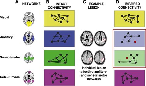 The Value Of Resting State Functional Magnetic Resonance Imaging In