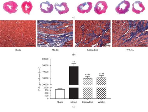 Figure From Wenxin Granules Influence The Tgf P Jnk Mapk Signaling