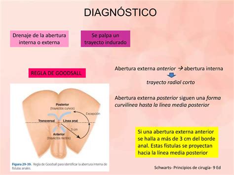 Abscesos Fistulas Anorectales Enfermedad Pilonidal Ppt