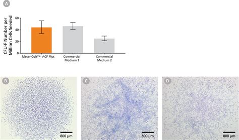 Mesencult Acf Plus Medium For Human Msc Culture Stemcell Technologies