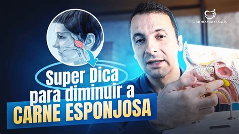 DICAS PRÁTICAS PARA DIMINUIR A CARNE ESPONJOSA ADENOIDE YouTube