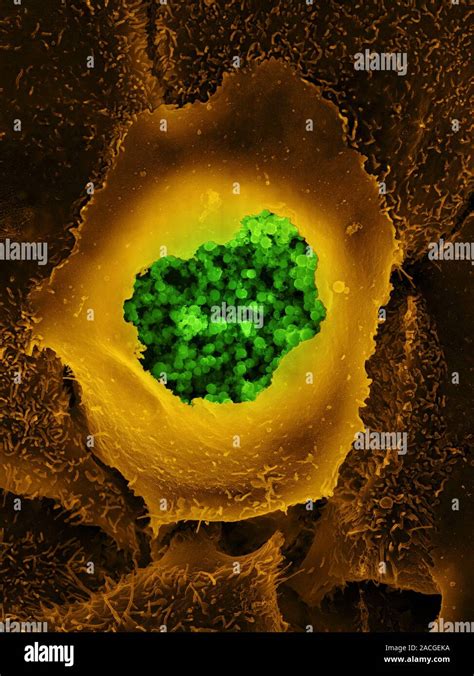 chlamydia coloured scanning electron micrograph sem  chlamydia