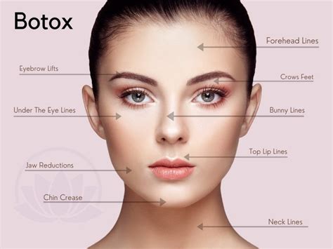 Botox Treatment In Milford Ct Cosmetic Frown Lines Crow S Feet