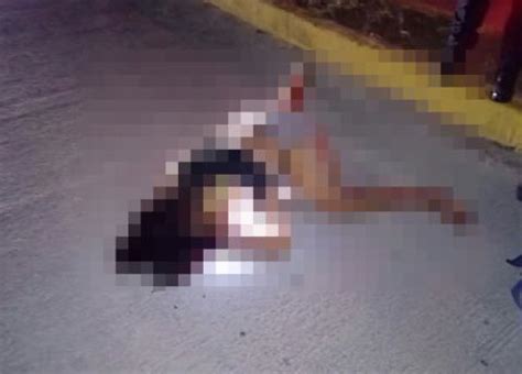 Mujer Derrapa En Su Moto Muere En El Hospital