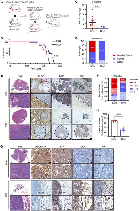 Epigenetic Reprogramming During Prostate Cancer Progression A