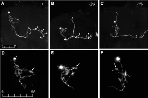 Figure 5 From Development Of The Drosophila Mushroom Bodies Sequential