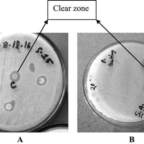 Growth Of Salmonella Spp On XLD Agar Plate A And Lactic Acid