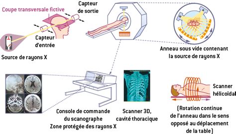 La Tomodensitom Trie Tdm Biologie Et Physiopathologie Humaines