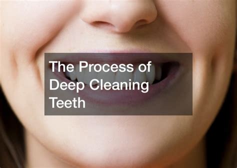 The Process Of Deep Cleaning Teeth Teeth Cavities