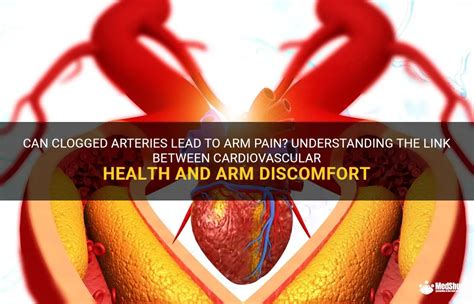 Can Clogged Arteries Lead To Arm Pain Understanding The Link Between