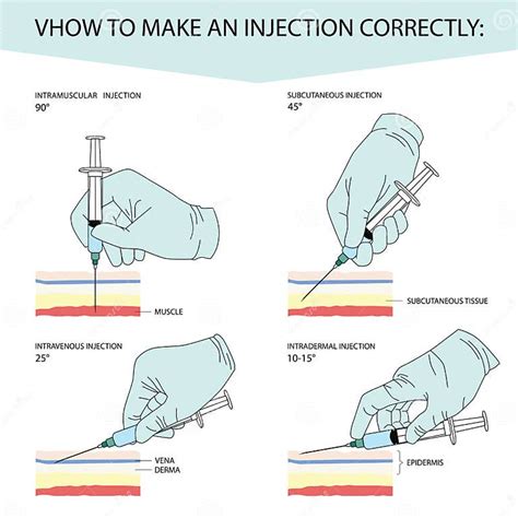 How To Make An Injection Correctly Infographics For Different Types Of Injections A Gloved