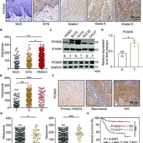 Higher Expression Of PCSK9 Is Correlated With Poorer Prognosis Of HNSCC