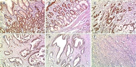 Immunohistochemical Staining Of Usp Proteins In Representa Tive