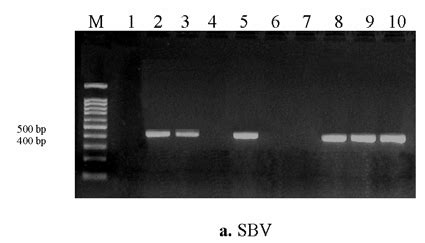 Agarose Gel Electrophoresis For Detection Of A Sbv And B Bqcv By