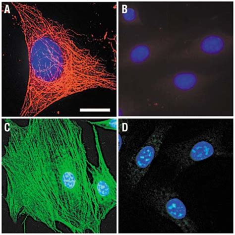 Staining Of Cytoskeleton Fibers In 3t3 Mouse Fibroblast Cells With