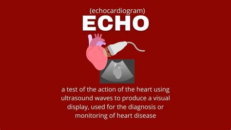 Echo Vs Ecg Vs Ekg What’s The Difference Capitalize My Title