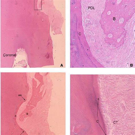 PDF Clinical And Histologic Evaluation Of Non Surgical Periodontal