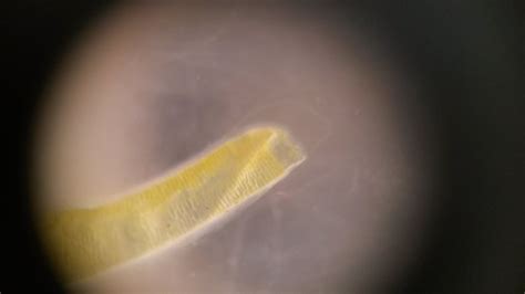 Ropeworm Beak Mouth Of Hookworm On Curezone Image Gallery