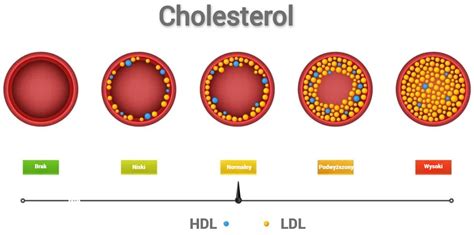 Cholesterol co to jest cholesterol normy dobry i zły dieta