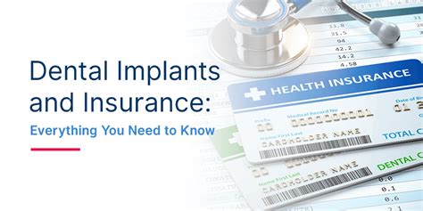 Does Dental Insurance Cover Implants? All You Need To Know