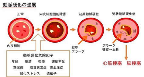 2019年4月よりオプション検査に「頸動脈超音波検査」が追加されました。 富山県厚生連滑川病院