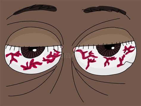 Bloodshot Eyes Cartoon Stock Illustration Illustration Of Bloodhot