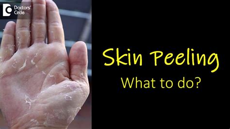 What Causes Skin Peeling From Fingers And Feet How To Manage Dr