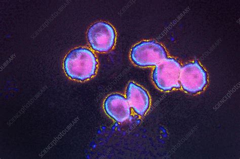 Pneumocystis Jirovecii Lm Stock Image C0362667 Science Photo Library