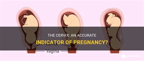 The Cervix: An Accurate Indicator Of Pregnancy? | ShunChild