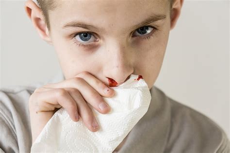 Nasenbluten Bei Kindern Ursachen Und Behandlung Ich Bin Mutter