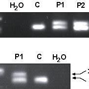 Confirmation Of The Mutation By BamHI Digestion After Polyacrylamide