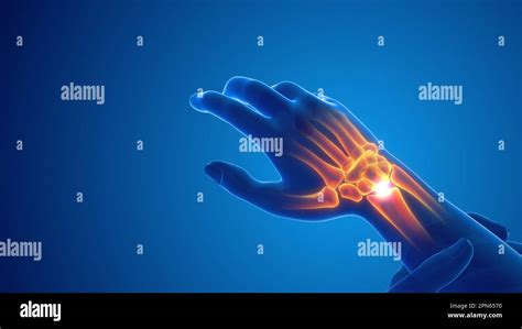 Pain In The Wrist Joint Stock Photo Alamy