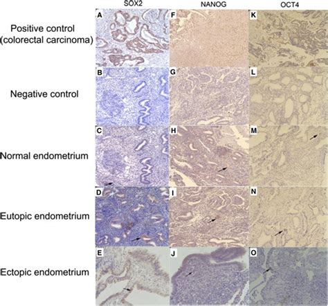 Sox2 Nanog And Oct4 Immunohistochemical Staining Paraffin Embedded