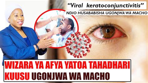 LIVE SERIKALI IMETOA TAHADHAL KUUSU UGONJWA WA MACHO RED EYES NA NJIA