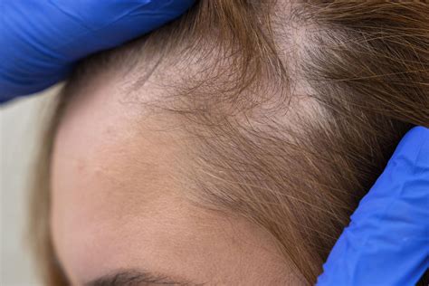 ¿cuáles Son Los Beneficios Del Colágeno Para El Pelo