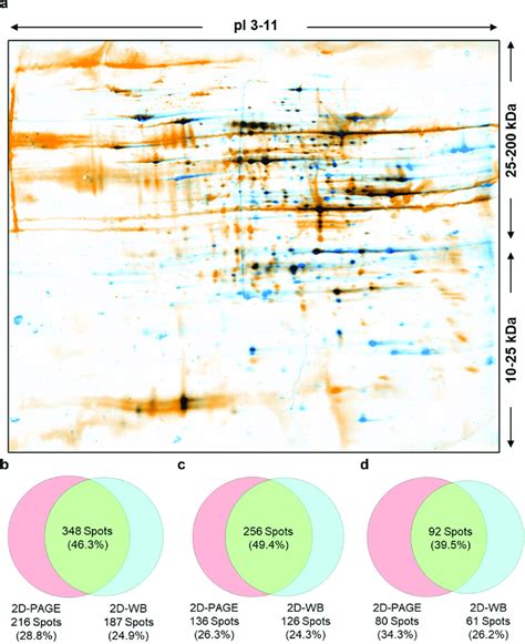 Results Of 2D Western Blot Analysis A Overlaid Images Of Silver