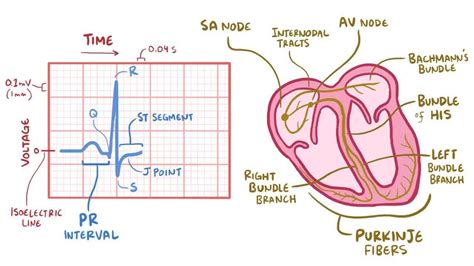 ECG normal sinus rhythm: Video, Causes, & Meaning | Osmosis